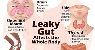 leaky gut info