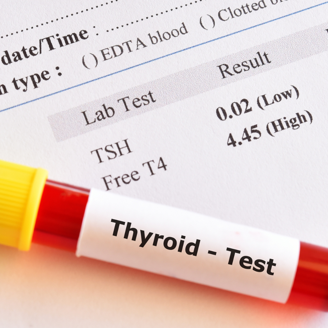 thyroid test